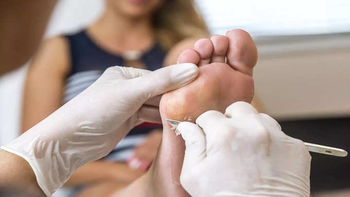 Don't forget only 4 things to prevent diabetic foot ulcers and follow..!-oneindia news